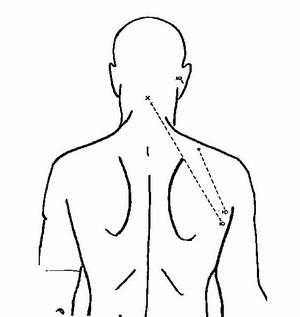 rfk_autopsy_diagram_061203_0046.jpg